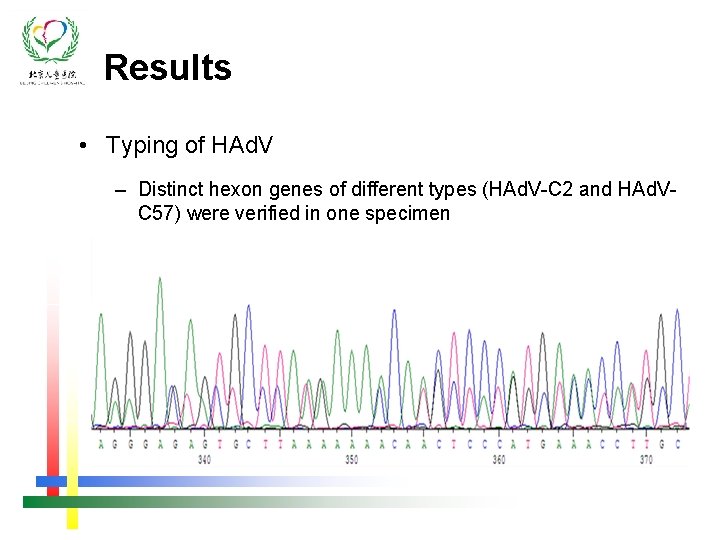 Results • Typing of HAd. V – Distinct hexon genes of different types (HAd.