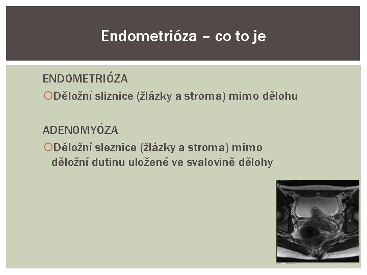 Endometrióza – co to je ENDOMETRIÓZA Děložní sliznice (žlázky a stroma) mimo dělohu ADENOMYÓZA