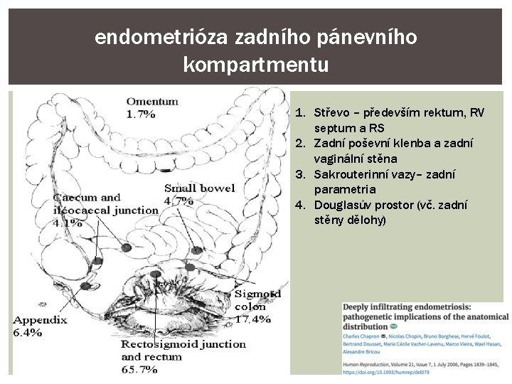 endometrióza zadního pánevního kompartmentu 1. Střevo – především rektum, RV septum a RS 2.
