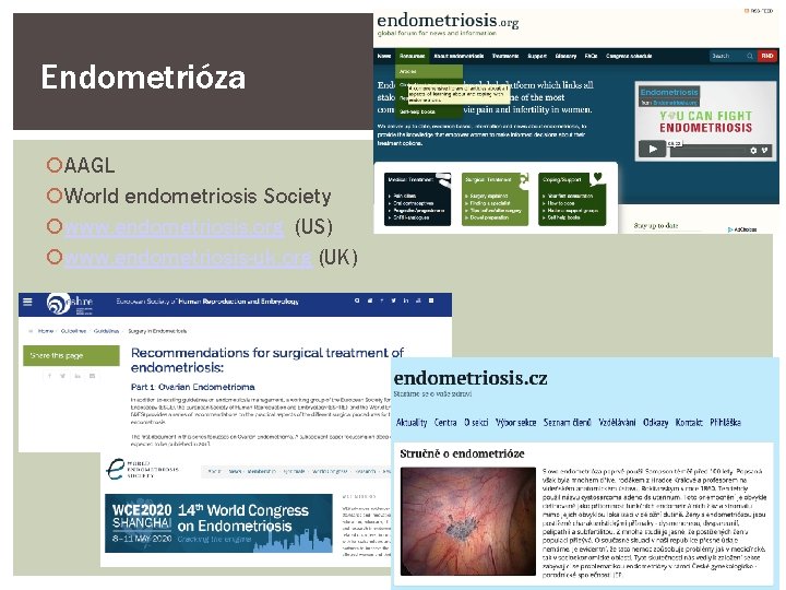 Endometrióza AAGL World endometriosis Society www. endometriosis. org (US) www. endometriosis-uk. org (UK) 