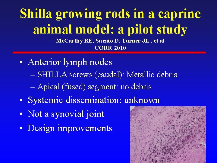 Shilla growing rods in a caprine animal model: a pilot study Mc. Carthy RE,