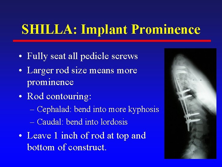 SHILLA: Implant Prominence • Fully seat all pedicle screws • Larger rod size means