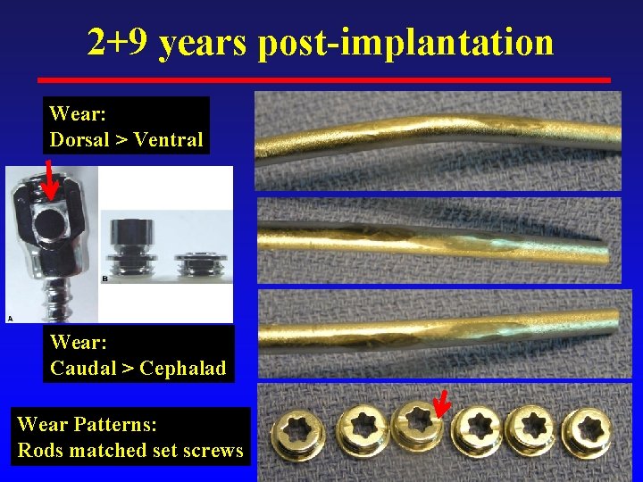 2+9 years post-implantation Wear: Dorsal > Ventral Wear: Caudal > Cephalad Wear Patterns: Rods