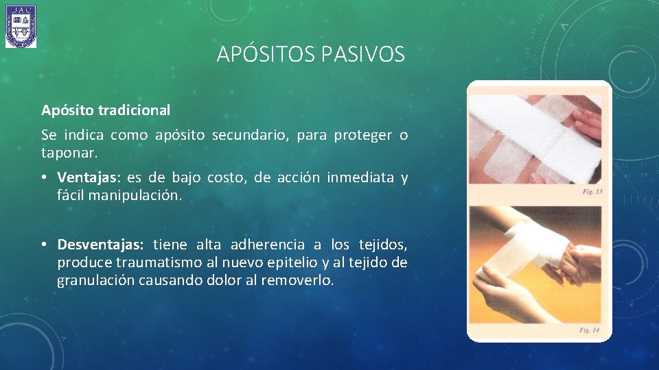 APÓSITOS PASIVOS Apósito tradicional Se indica como apósito secundario, para proteger o taponar. •