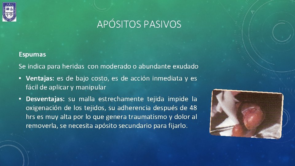 APÓSITOS PASIVOS Espumas Se indica para heridas con moderado o abundante exudado • Ventajas: