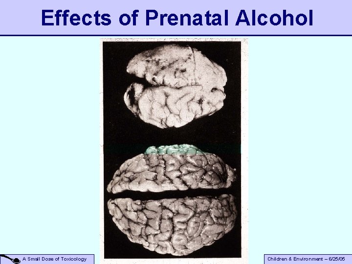 Effects of Prenatal Alcohol A Small Dose of Toxicology Children & Environment – 6/25/05