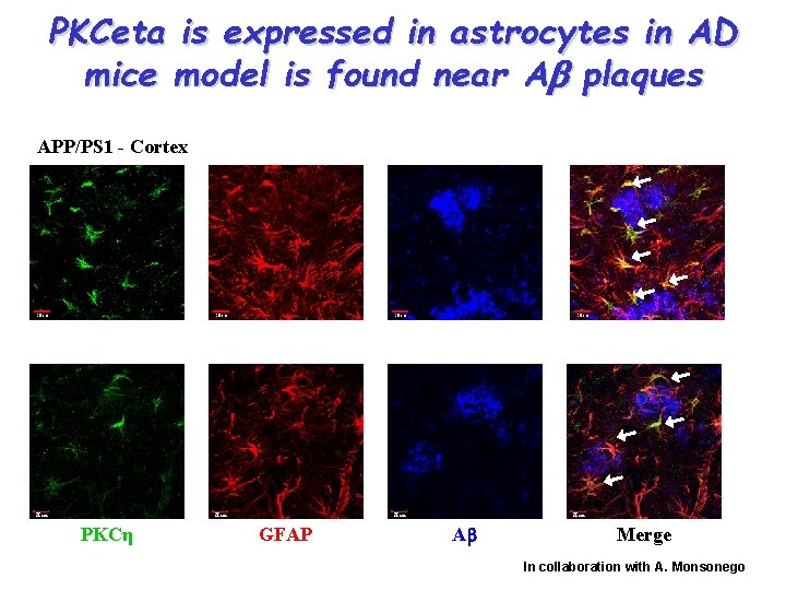 PKCeta is expressed in astrocytes in AD mice model is found near Ab plaques