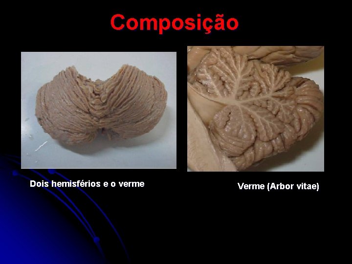 Composição Dois hemisférios e o verme Verme (Arbor vitae) 