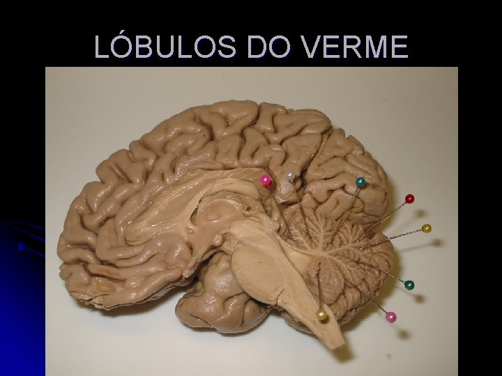LÓBULOS DO VERME 
