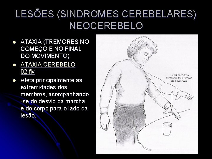 LESÕES (SINDROMES CEREBELARES) NEOCEREBELO l l l ATAXIA (TREMORES NO COMEÇO E NO FINAL