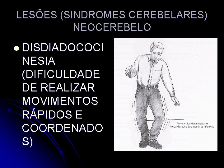 LESÕES (SINDROMES CEREBELARES) NEOCEREBELO l DISDIADOCOCI NESIA (DIFICULDADE DE REALIZAR MOVIMENTOS RÁPIDOS E COORDENADO