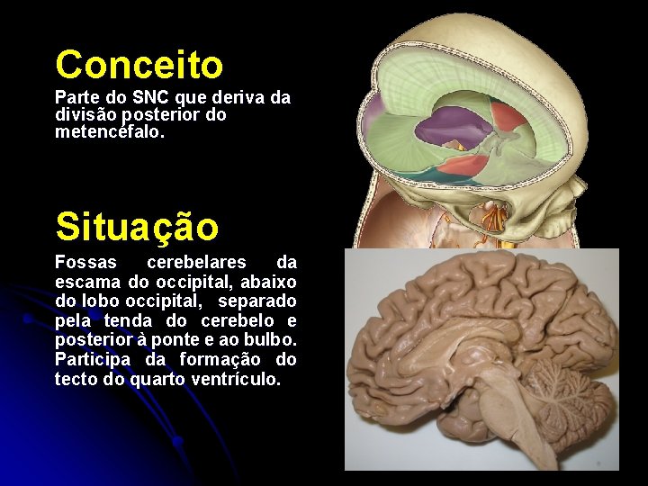 Conceito Parte do SNC que deriva da divisão posterior do metencéfalo. Situação Fossas cerebelares