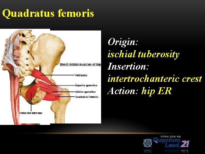 Quadratus femoris Origin: ischial tuberosity Insertion: intertrochanteric crest Action: hip ER 