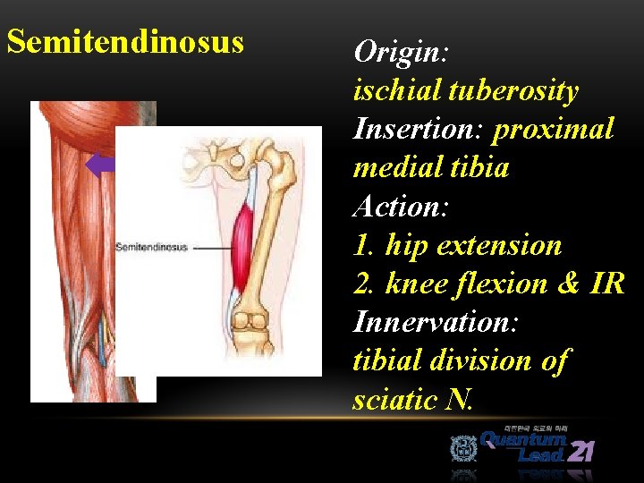 Semitendinosus Origin: ischial tuberosity Insertion: proximal medial tibia Action: 1. hip extension 2. knee
