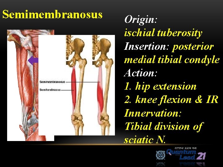 Semimembranosus Origin: ischial tuberosity Insertion: posterior medial tibial condyle Action: 1. hip extension 2.