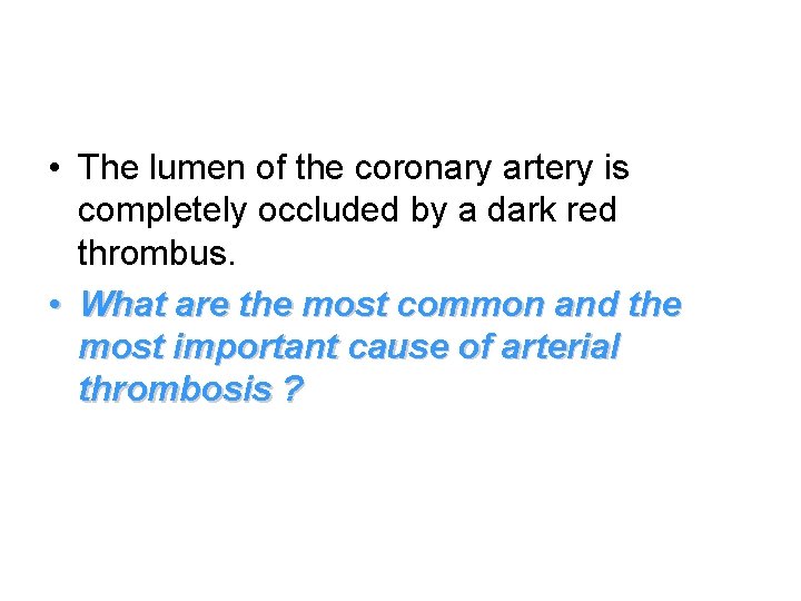  • The lumen of the coronary artery is completely occluded by a dark