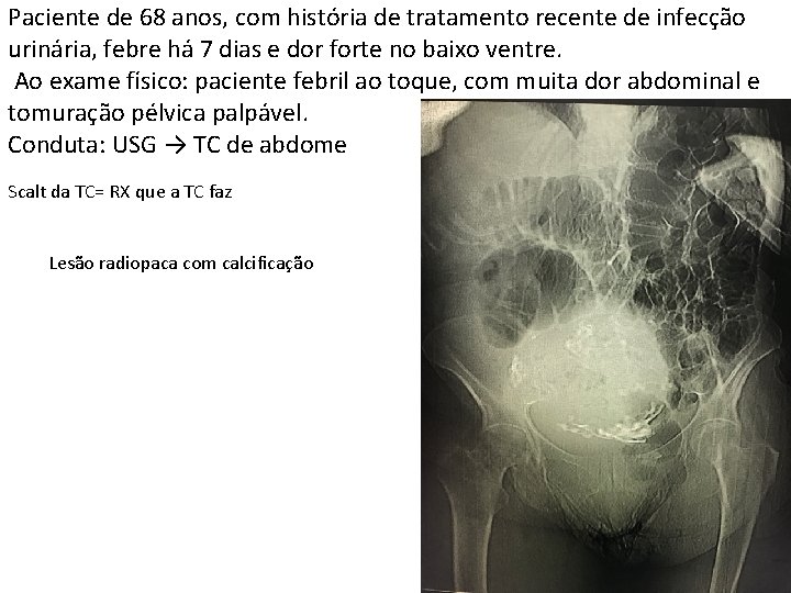 Paciente de 68 anos, com história de tratamento recente de infecção urinária, febre há