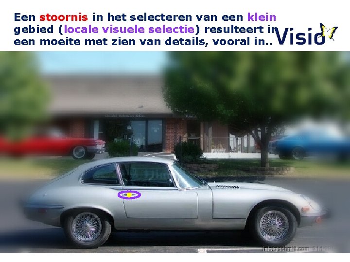 Een stoornis in het selecteren van een klein gebied (locale visuele selectie) resulteert in Een stoornis in het selecteren van een klein gebied (locale visuele selectie) resulteert in