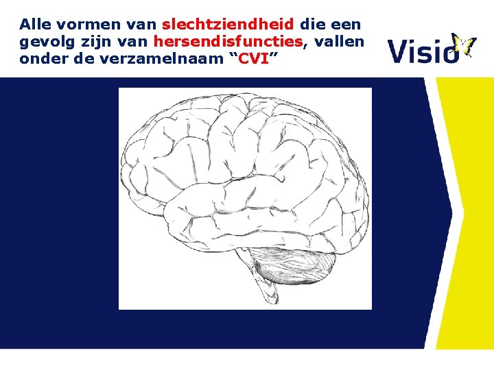 Alle vormen van slechtziendheid die een gevolg zijn van hersendisfuncties, vallen onder de verzamelnaam Alle vormen van slechtziendheid die een gevolg zijn van hersendisfuncties, vallen onder de verzamelnaam