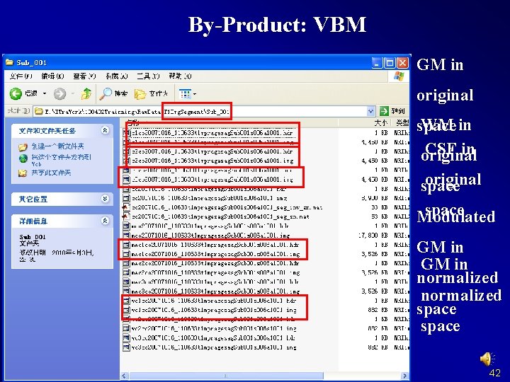 By-Product: VBM GM in original WM in space CSF in original space Modulated GM
