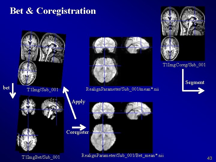 Bet & Coregistration T 1 Img. Coreg/Sub_001 bet Segment Realign. Parameter/Sub_001/mean*. nii T 1
