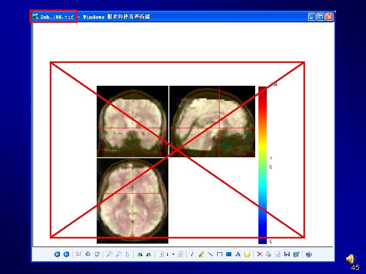 Normalize Check Normalization with DPARSF {WORKINGDIR}Pictures. For. Chk. Normalization 45 