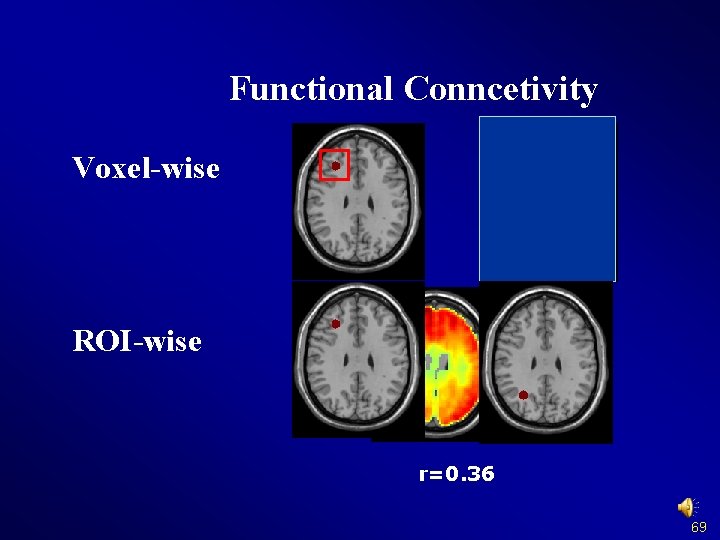 Functional Conncetivity Voxel-wise ROI-wise r=0. 36 69 