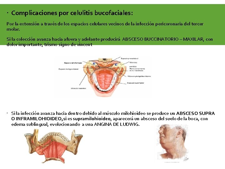  Complicaciones por celulitis bucofaciales: Por la extensión a través de los espacios celulares