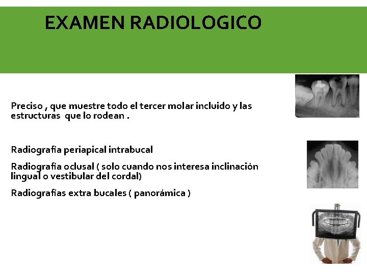 EXAMEN RADIOLOGICO Preciso , que muestre todo el tercer molar incluido y las estructuras