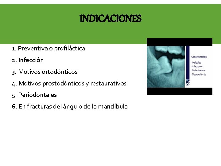 INDICACIONES 1. Preventiva o profiláctica 2. Infección 3. Motivos ortodónticos 4. Motivos prostodónticos y
