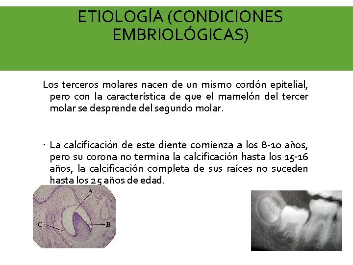 ETIOLOGÍA (CONDICIONES EMBRIOLÓGICAS) Los terceros molares nacen de un mismo cordón epitelial, pero con