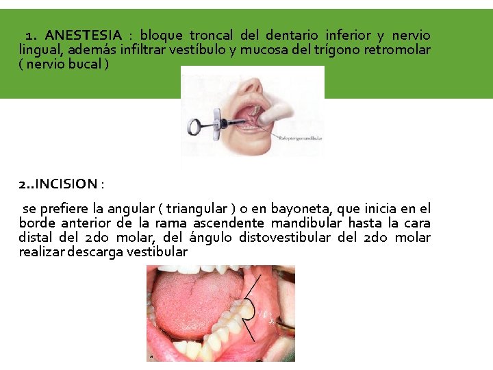 1. ANESTESIA : bloque troncal dentario inferior y nervio lingual, además infiltrar vestíbulo y