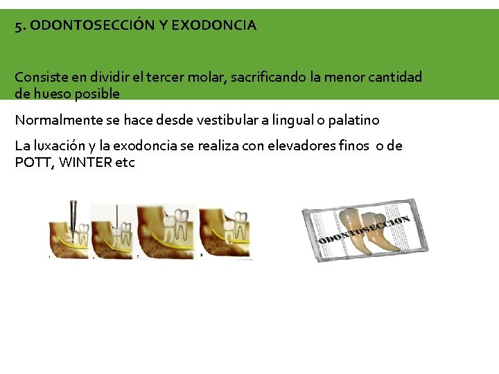5. ODONTOSECCIÓN Y EXODONCIA Consiste en dividir el tercer molar, sacrificando la menor cantidad