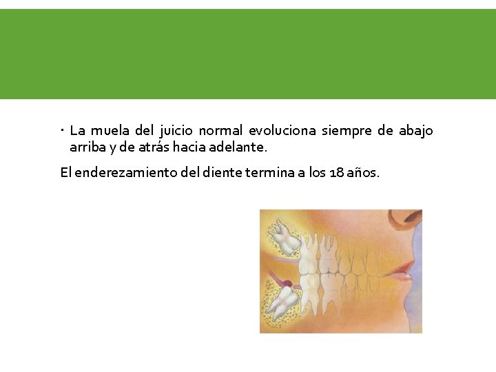  La muela del juicio normal evoluciona siempre de abajo arriba y de atrás