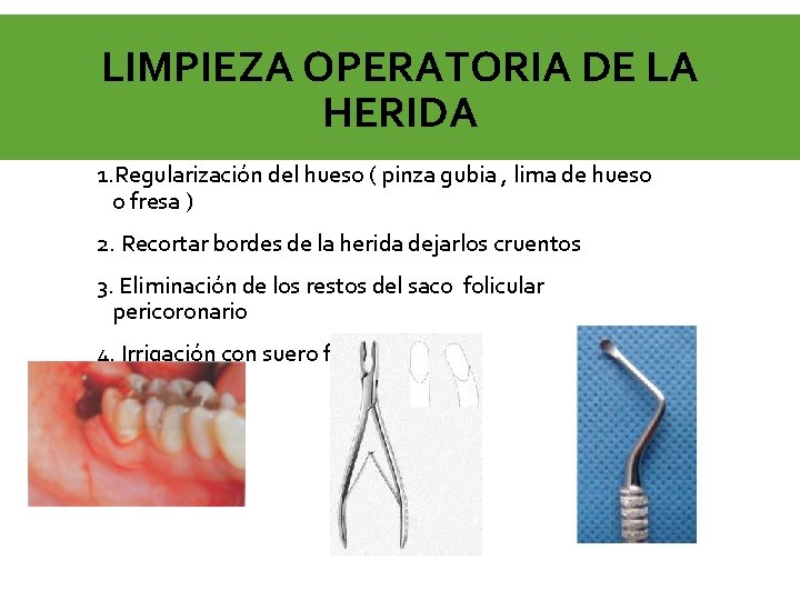 LIMPIEZA OPERATORIA DE LA HERIDA 1. Regularización del hueso ( pinza gubia , lima