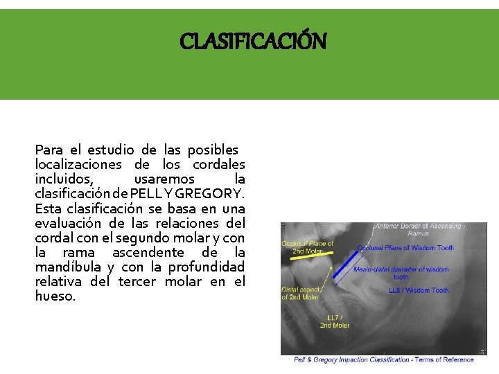 CLASIFICACIÓN Para el estudio de las posibles localizaciones de los cordales incluidos, usaremos la