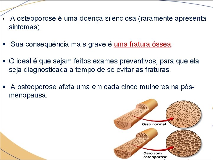 § A osteoporose é uma doença silenciosa (raramente apresenta sintomas). § Sua consequência mais