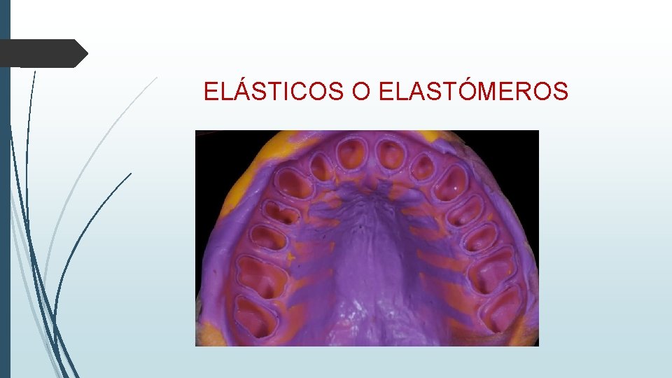 ELÁSTICOS O ELASTÓMEROS 