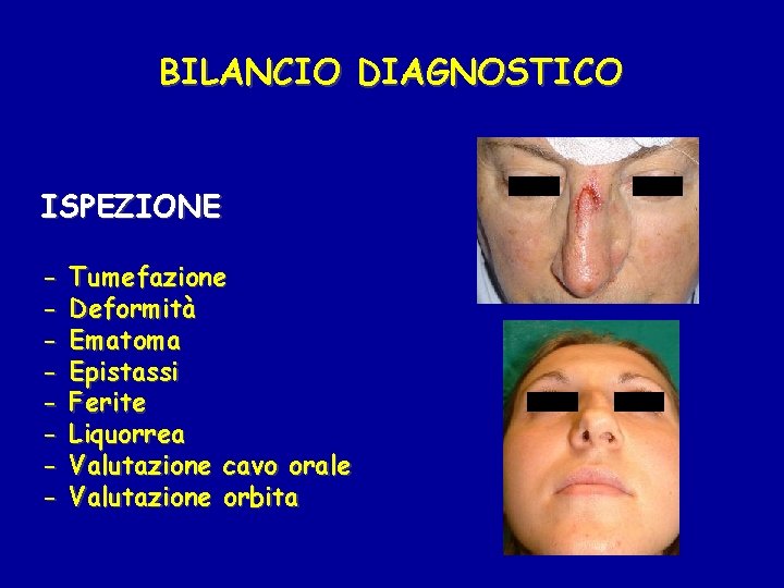 BILANCIO DIAGNOSTICO ISPEZIONE - Tumefazione Deformità Ematoma Epistassi Ferite Liquorrea Valutazione cavo orale Valutazione