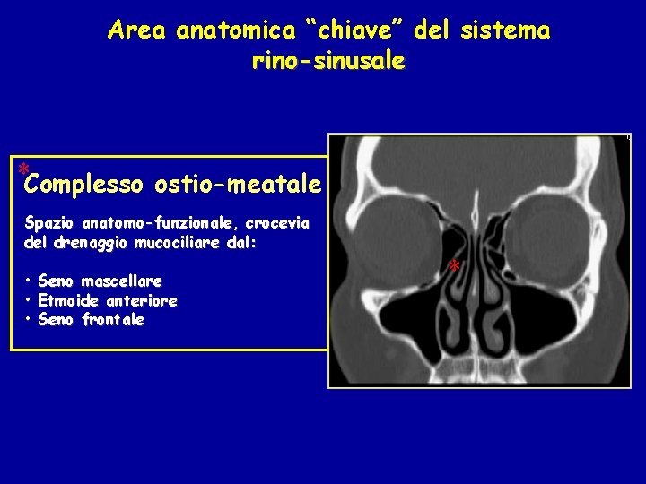 Area anatomica “chiave” del sistema rino-sinusale *Complesso ostio-meatale Spazio anatomo-funzionale, crocevia del drenaggio mucociliare