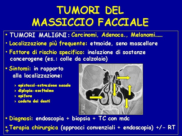 TUMORI DEL MASSICCIO FACCIALE • TUMORI MALIGNI: Carcinomi, Adenoca. , Melanomi…… • Localizzazione più