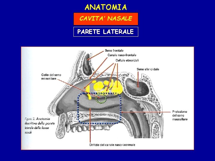 ANATOMIA CAVITA’ NASALE PARETE LATERALE 