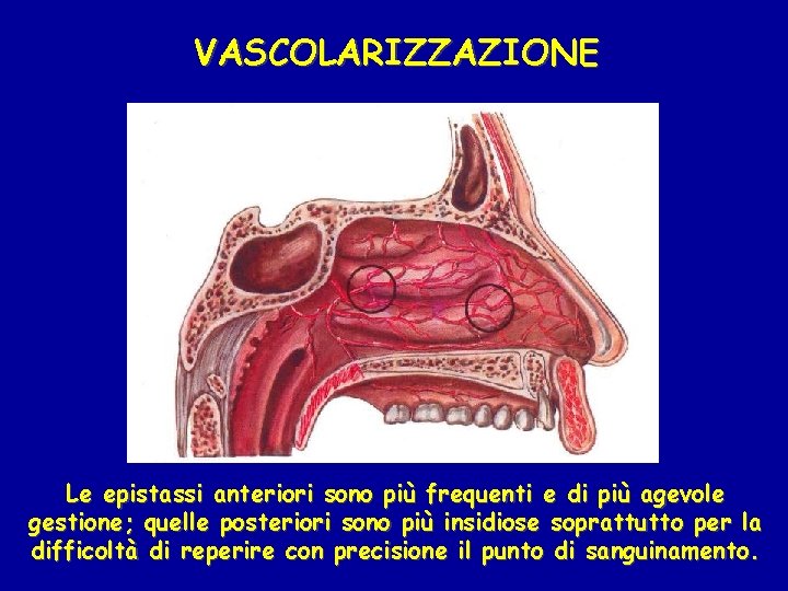 VASCOLARIZZAZIONE Le epistassi anteriori sono più frequenti e di più agevole gestione; quelle posteriori