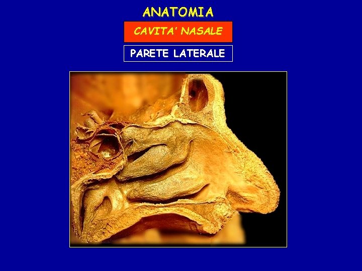 ANATOMIA CAVITA’ NASALE PARETE LATERALE 