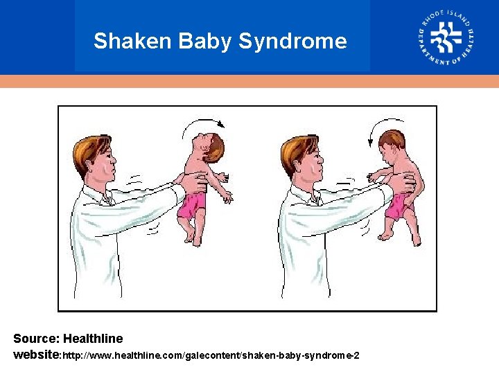 Shaken Baby Syndrome Source: Healthline website: http: //www. healthline. com/galecontent/shaken-baby-syndrome-2 
