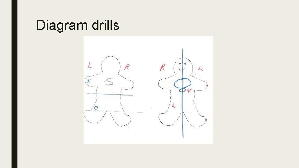 Diagram drills 
