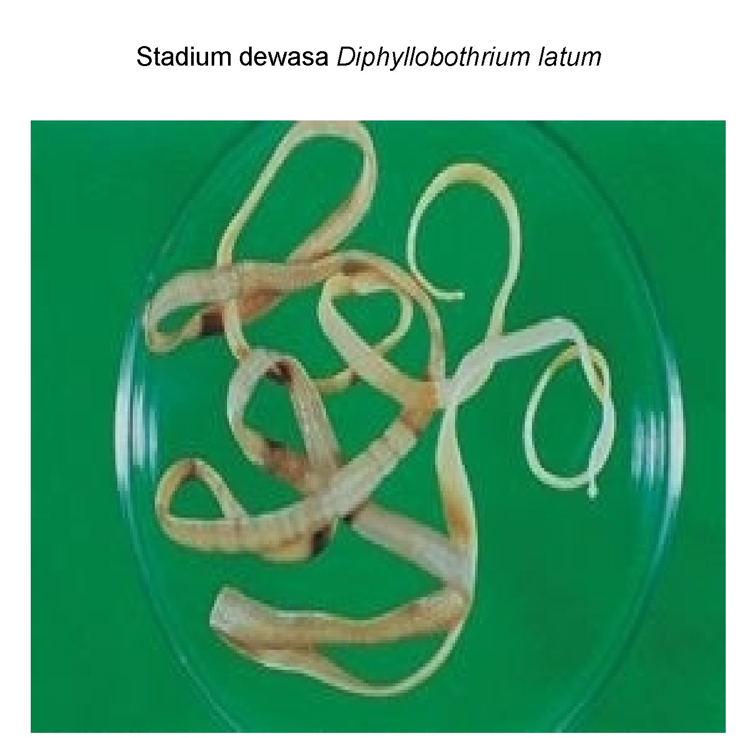 Stadium dewasa Diphyllobothrium latum 111 