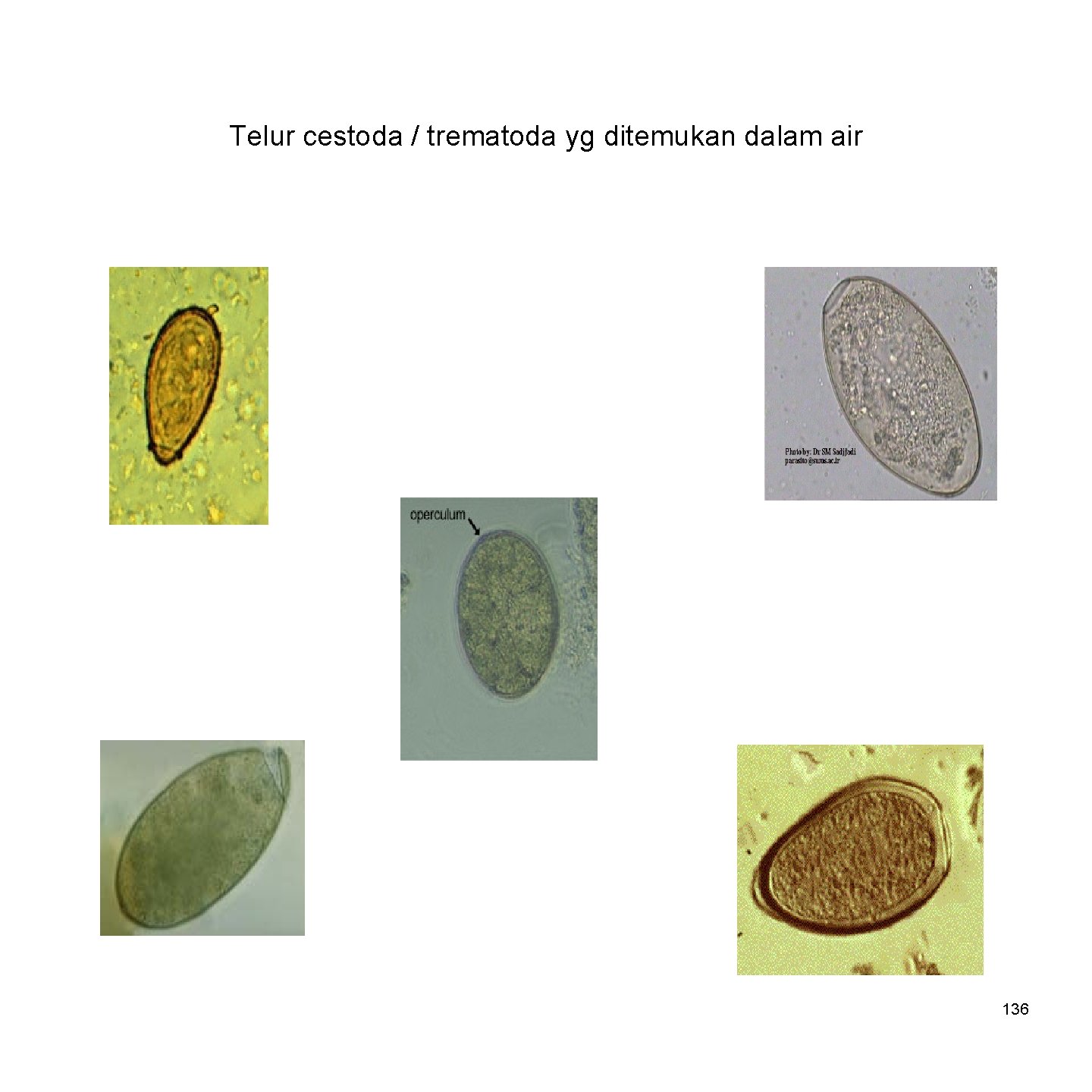 Telur cestoda / trematoda yg ditemukan dalam air 136 