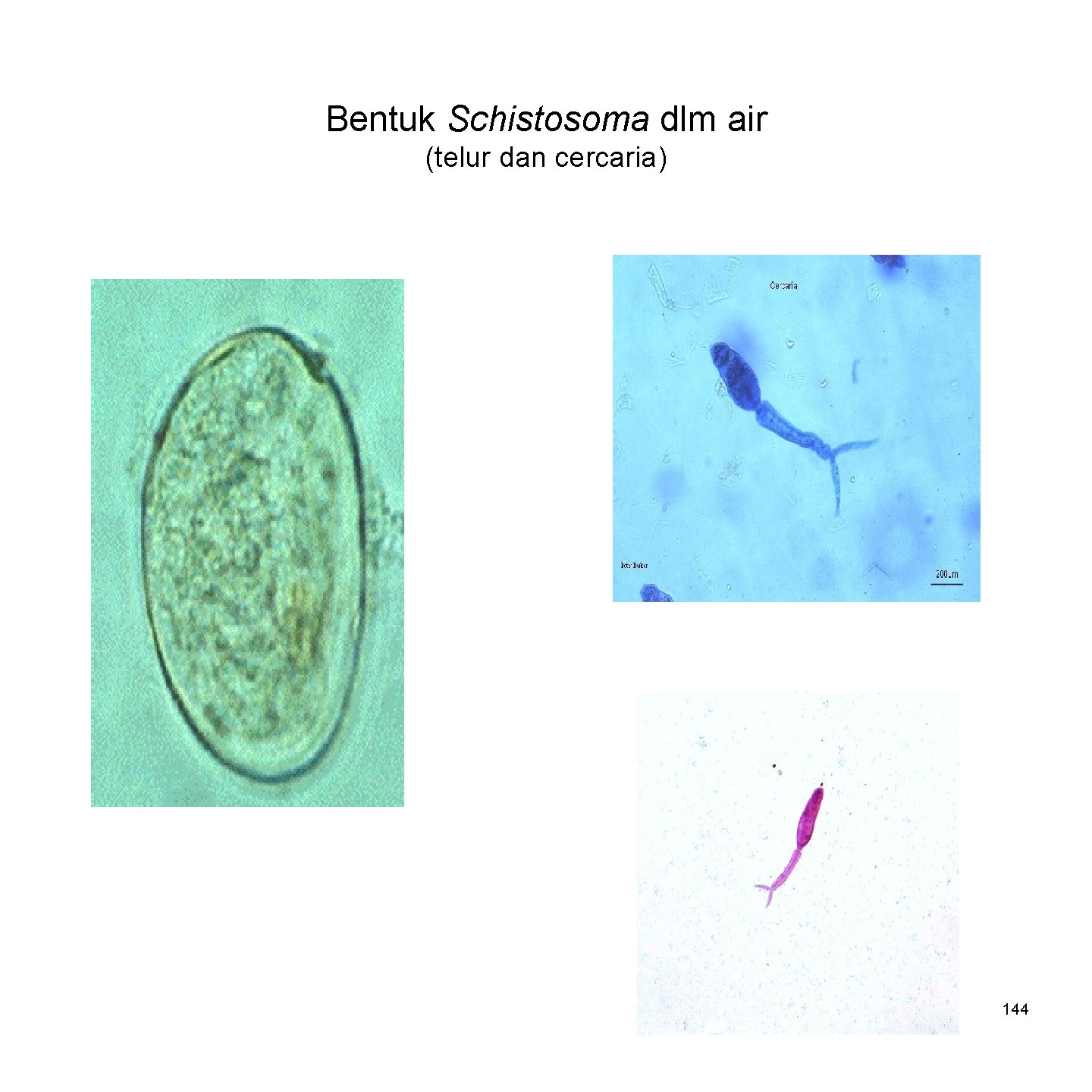 Bentuk Schistosoma dlm air (telur dan cercaria) 144 