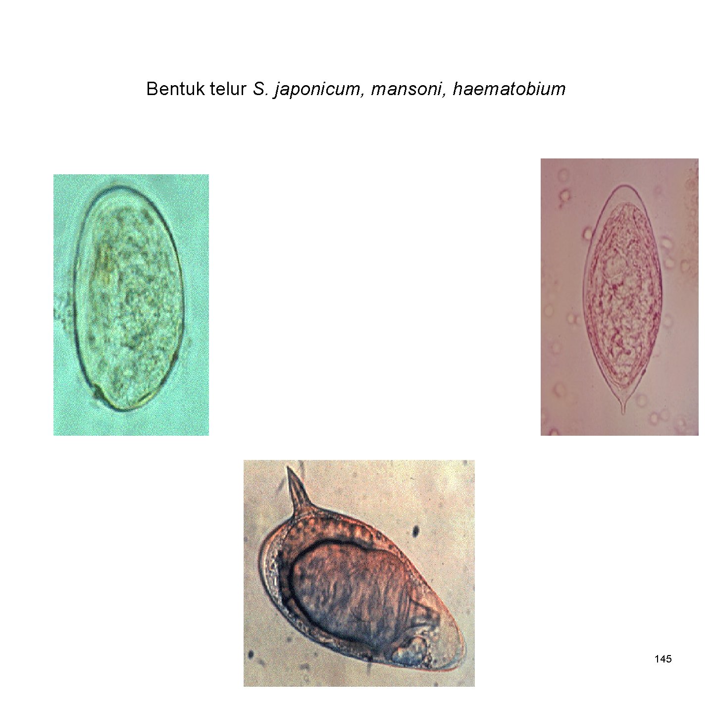 Bentuk telur S. japonicum, mansoni, haematobium 145 